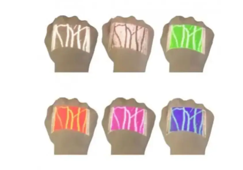 Візуалізатор вен, венолокатор Medcaptain NAVI-60 (Сертифіковано в Україні) - Зображення 7