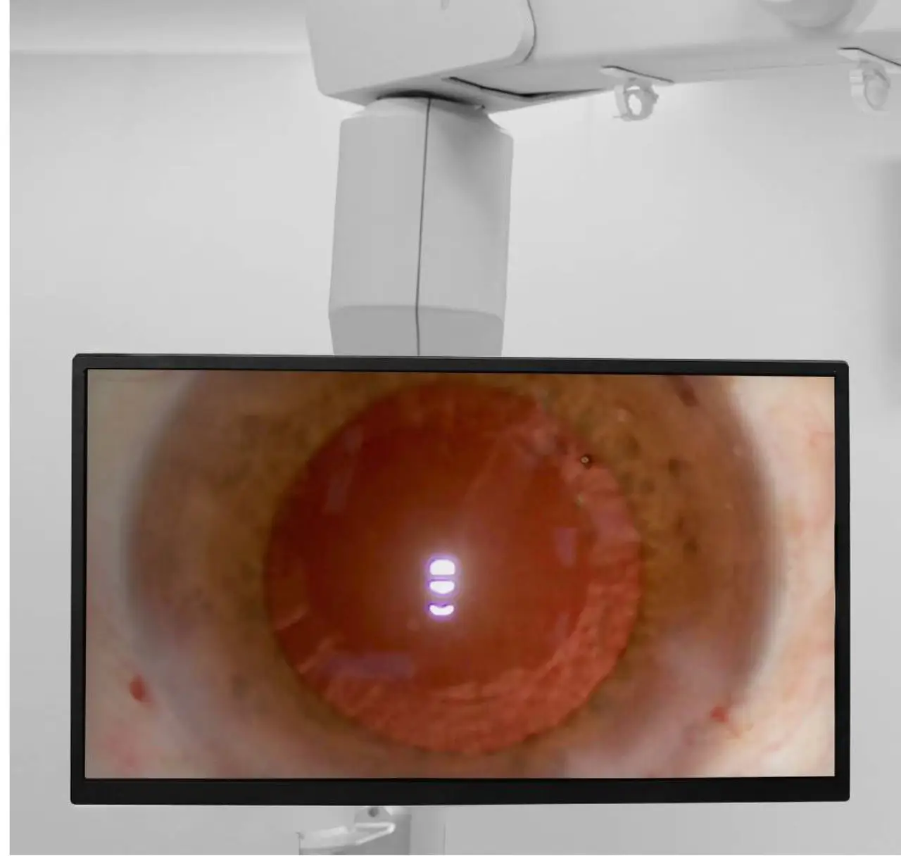 Medi Works SM621 офтальмологічний хірургічний мікроскоп - Зображення 6